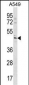 TBC1D20 Antibody (C-term)
